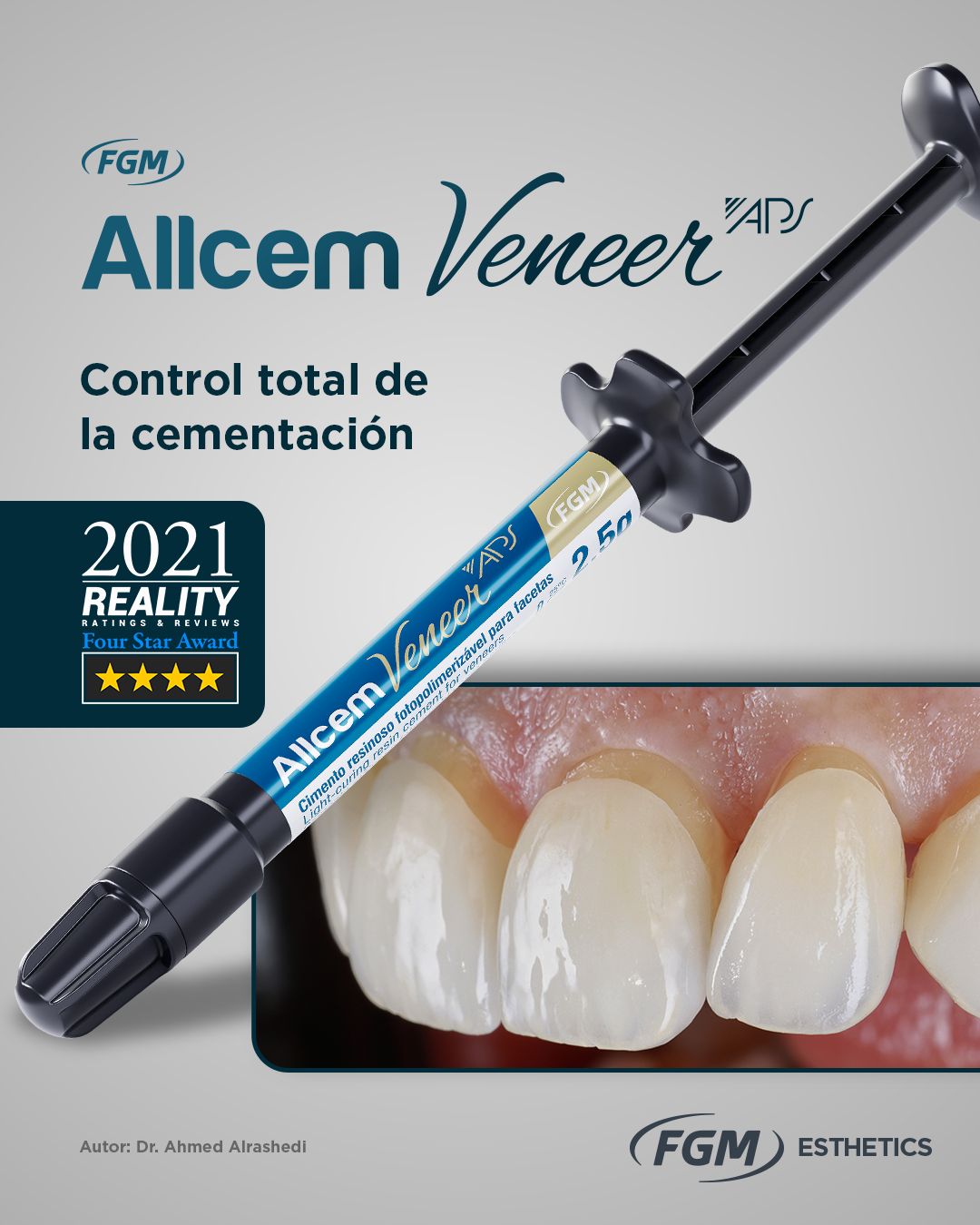 Allcem Veneer APS – Premium Light-Cured Resin Cement for Veneers & Esthetic Restorations